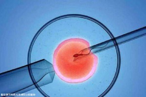 包生男孩试管机构生殖医学中心